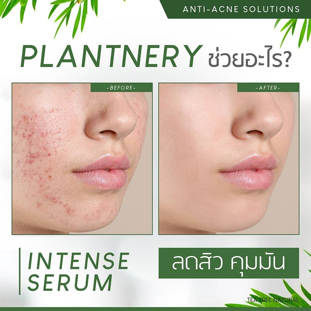 Plantnery Tea Tree Intense Serum