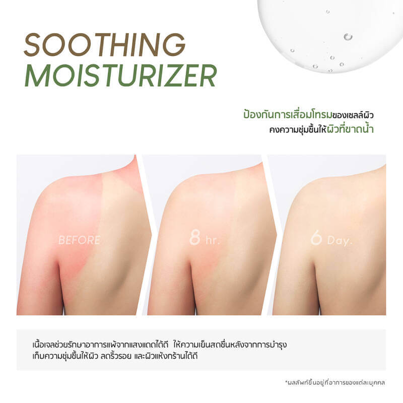 Plantnery™ Aloe Vera Soothing Gel มีฤทธิ์ในการลดเลือนริ้วรอยจุดด่างดำและแผลสมาน ปลอดภัย ไม่ระคายเคืองต่อผิวหนังและรอบดวงตา 